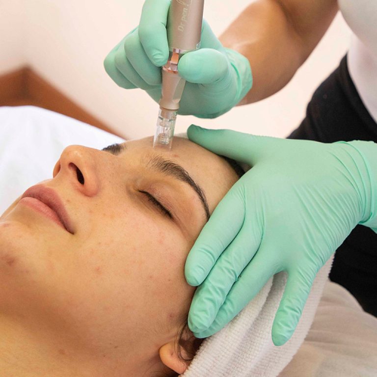 dermapenfacial