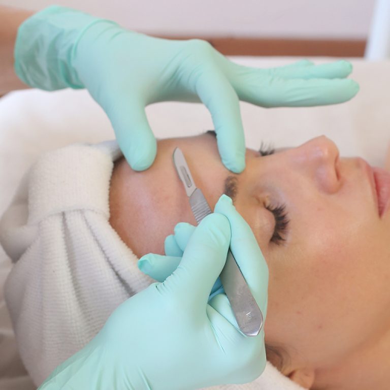 dermaplaningfacial